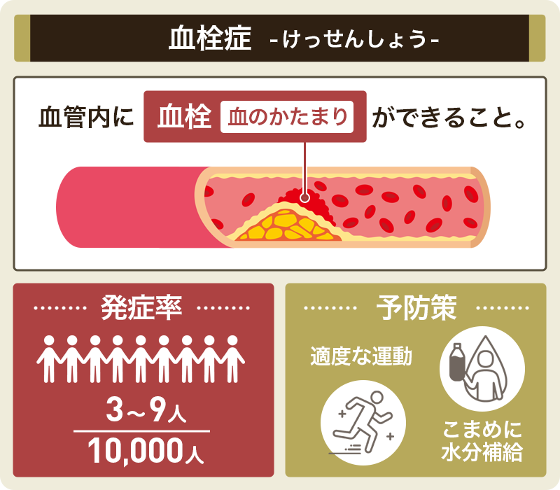 ピルの副作用血栓症とは